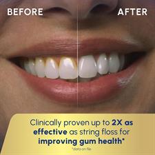 Waterpik Aquarius Water Flosser Ultra Professional For Teeth, Gums, Braces, Dental Care 7 Tips WP-660
