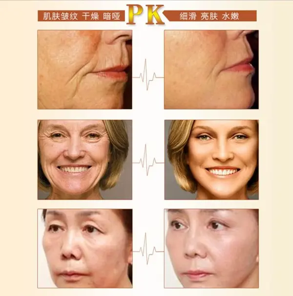 AICHUN BEAUTY Whitening Gold Caviar Peel Off Mask 120ml – Face Rejuvenation, Moisturizing & Brightening Mask
