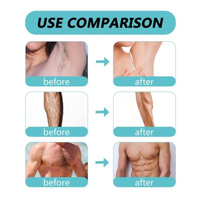 Ecrin Quick & Easy Hair Removal Spray Say goodbye to unwanted hair 150ml