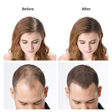 Dexe Hair Fiber